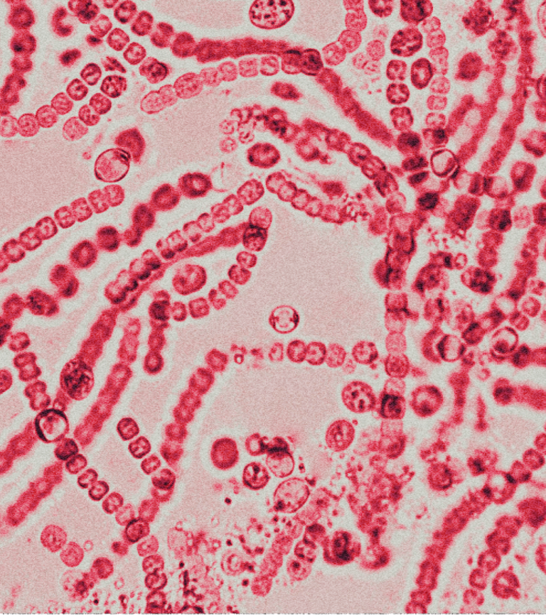Bifidobacterium Lactis